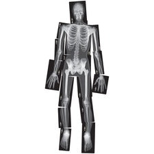 Roylco True to Life Human X-rays Set